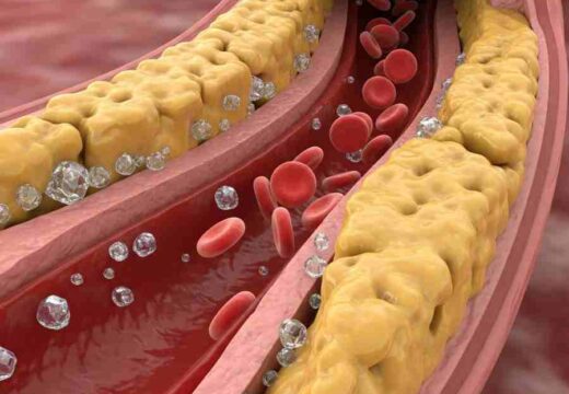 মাত্র এক মাসেই নিয়ন্ত্রণে আসতে পারে কোলেস্টেরল