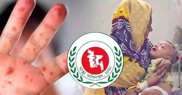 হামের উপসর্গে আরও ৩ শিশুর মৃত্যু, মোট প্রাণহানি ১,০৯৯
